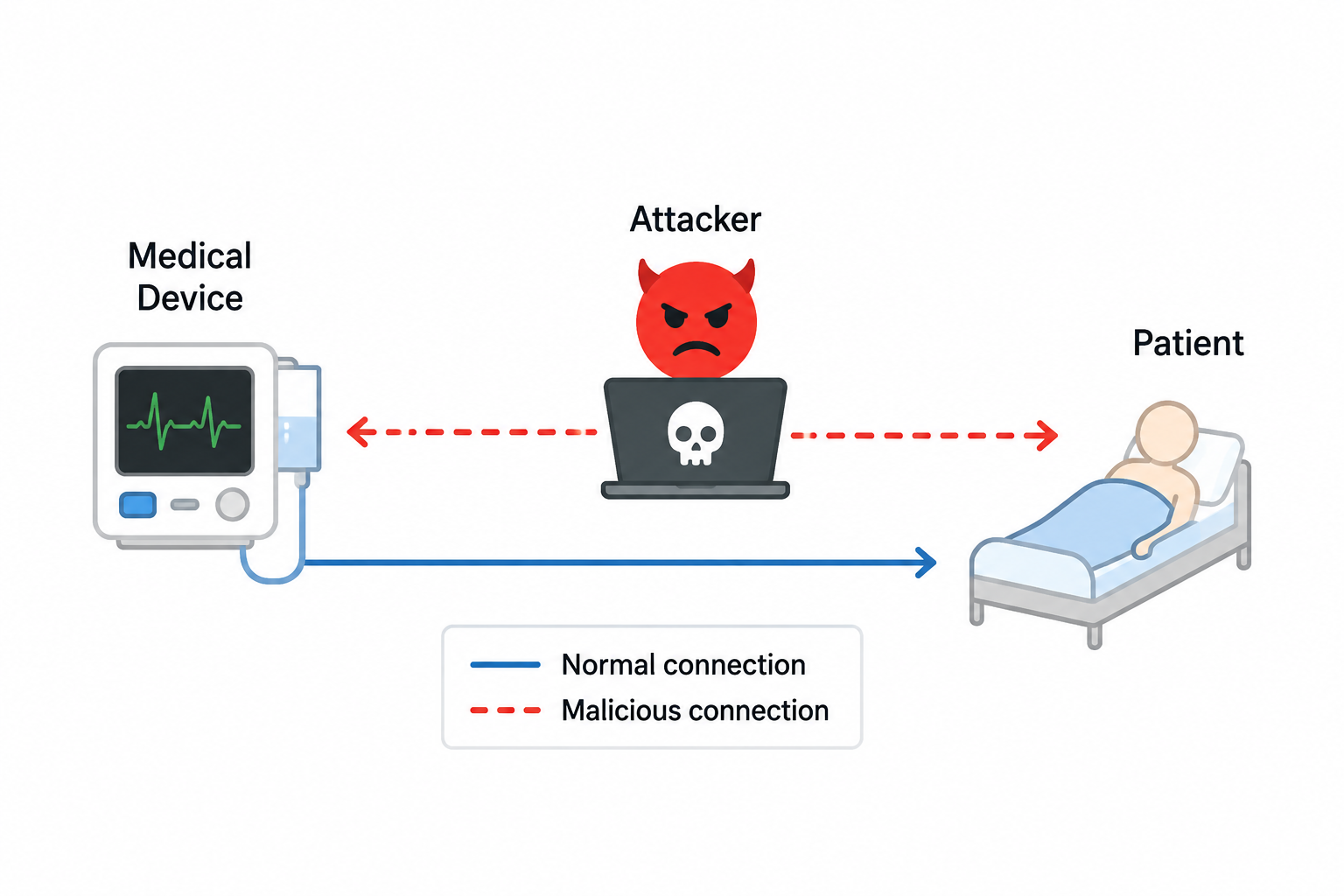 XDGMed — Explainable Attack Detection Using Graphs for Medical Devices